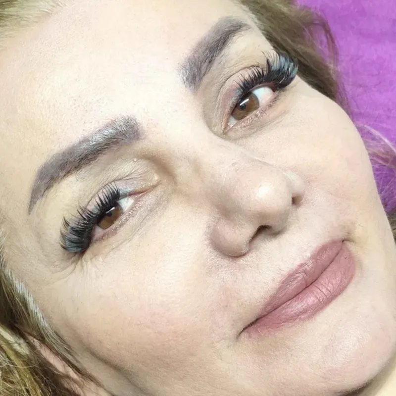 کاشت مژه ردمی دبل